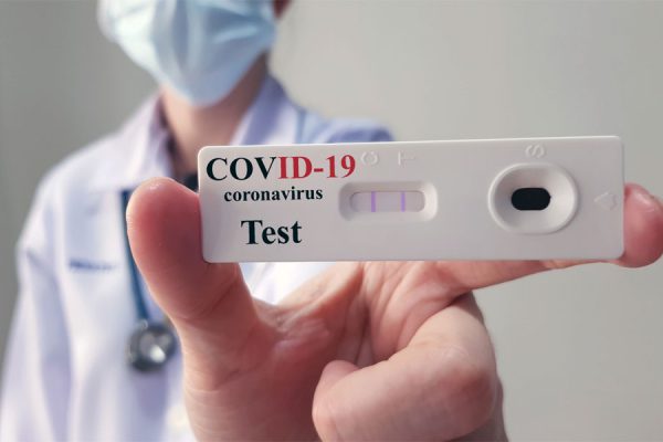 Teste de Coronavírus é obrigatório para planos de saúde